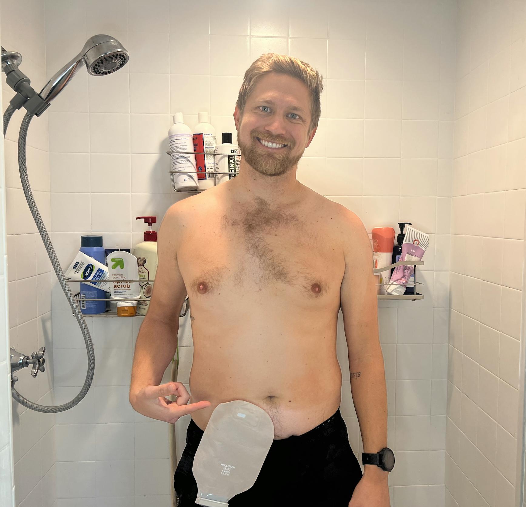 Things You Should Know About Showering With an Ostomy