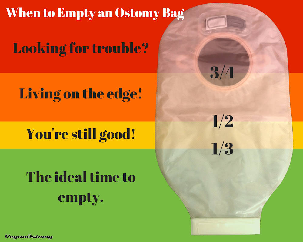 How and when to change a colostomy bag